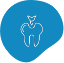 Dental Fillings